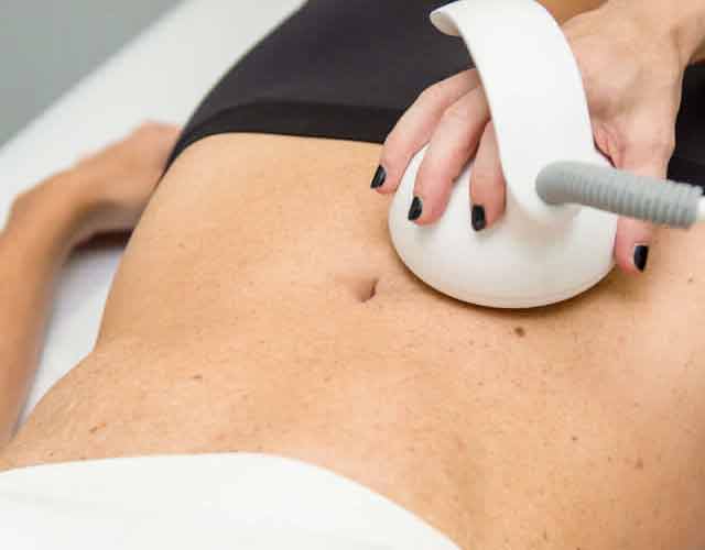radiofrecuencia abdominal para estrías radiofrecuencia abdominal para estrías